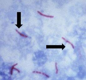 Mycobacterium-tuberculosis