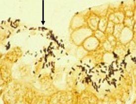 Mycobacterium-pylori
